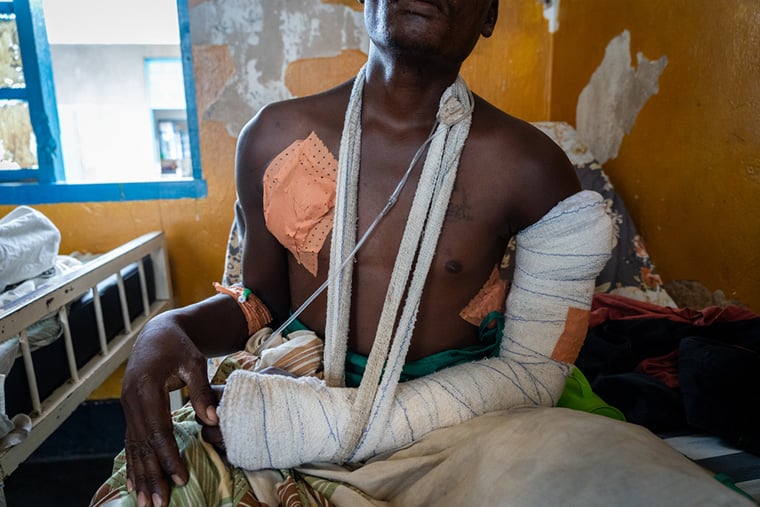 北キブ州ムウェソで治療を受ける男性。武装集団の支配する道は危険が伴うため、病院にたどり着くまでに数日を要した＝2025年10月1日　© Sam Bradpiece/MSF