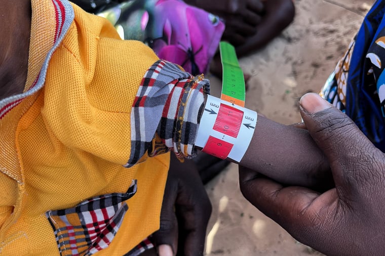 子どもの腕に巻いて栄養状態の検査をする命のうでわ。赤色は重度の状態であることを示す＝チャドで2025年11月5日　© Léa Gillabert/MSF