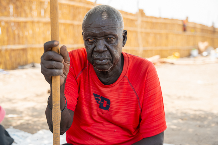 南スーダンの避難民、モーゼスさん＝チュイルで2026年3月12日　© Isaac Buay/MSF