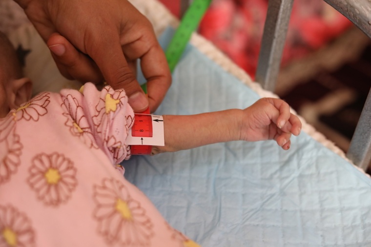 ガザの避難所で暮らす生後5カ月の赤ちゃん。栄養状態の指標が赤色を示し、重度の栄養失調と診断された＝2025年5月1日　© Nour Alsaqqa/MSF