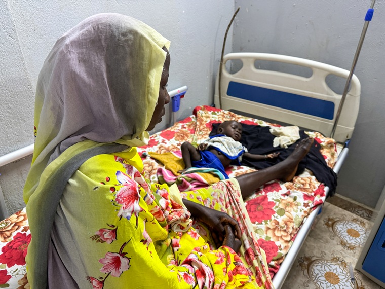 はしかと重度の栄養失調を患う赤ちゃん。紛争が続く中、医療や食料へのアクセスは極めて限られており、子どもたちはとりわけ深刻な危険にさらされている＝2025年12月14日　© Natalia Romero Peñuela/MSF