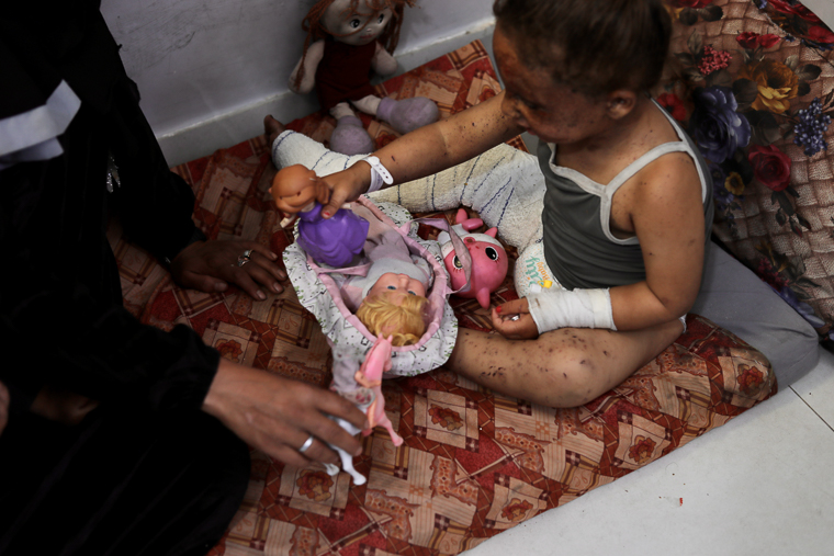 ナセル病院にあるMSFのやけど病棟で治療を受ける女の子（右）。イスラエル軍による空爆で母親ときょうだい2人が殺害された＝2025年5月1日　© Nour Alsaqqa/MSF