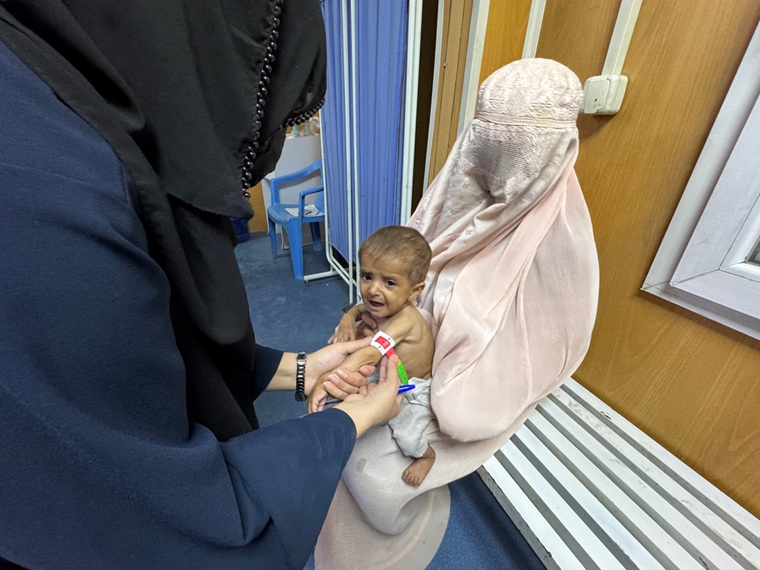 アフガニスタン南部カンダハル州にある国境なき医師団（MSF）の外来栄養治療センターを訪れた親子。子どもの腕に巻かれた栄養状態を測定する「命のうでわ」は、重度の栄養失調を示す赤色を指している＝2026年6月21日　© Nazia Kamal/MSF