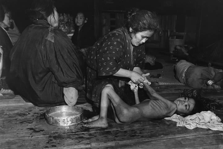 重度の栄養失調で起き上がることもできず、身体を拭いてもらう少女。70年前、激しい戦闘にさらされた沖縄では、各島で深刻な食糧不足が起きていた。当時の沖縄は、マラリアがまん延する地域でもあった。