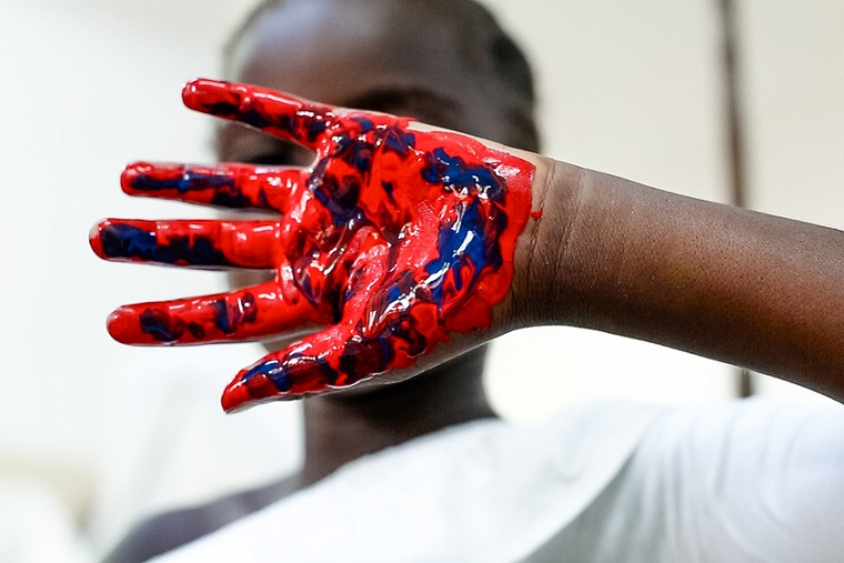 HIV／エイズの治療のため入院している子ども。この日はウォールペインティングが行われた。<br> コンゴでは7万人以上の子どもがHIV陽性だが、治療を受けているのは半分以下だ=2018年　<br> © Ghislain Massotte/MSF 