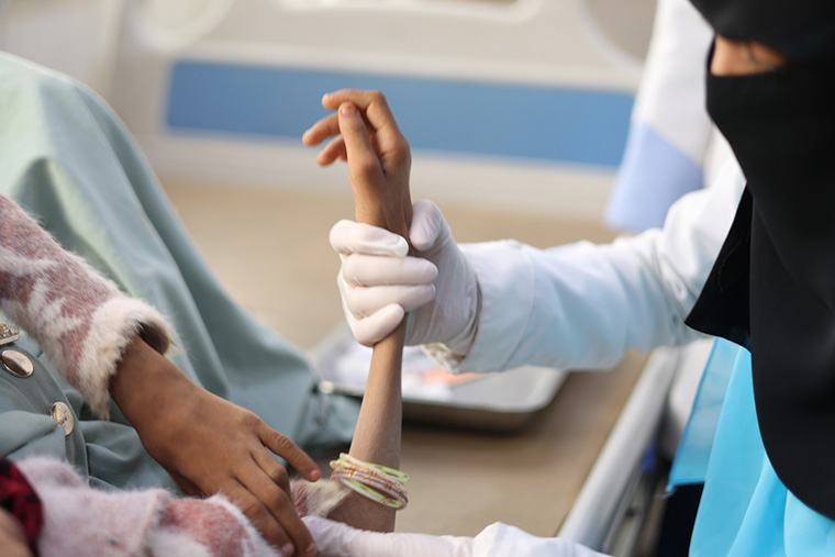 アル・サラム病院で栄養失調の患者を診察する看護師=アムラン県、ハミール Ⓒ Athmar Mohammed/MSF