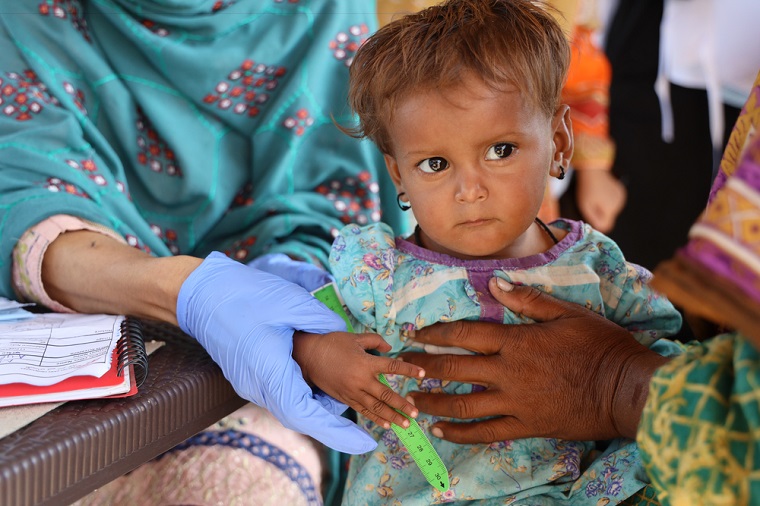 栄養失調の検査を受ける子ども。畑や家畜が失われたことで食料不足が深刻に　© Zahra Shoukat/MSF