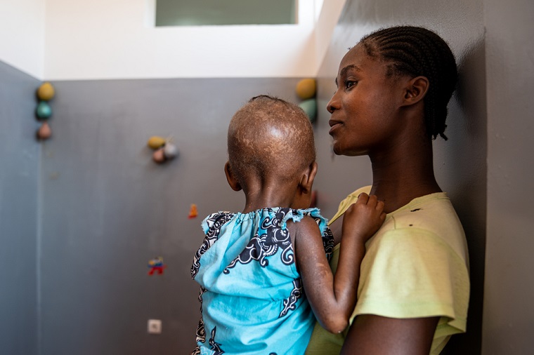 栄養失調になった我が子を抱える母親 © Mariana Abdalla/MSF