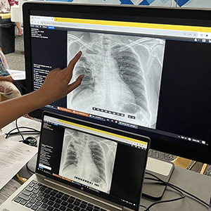 X線で撮影された画像 © MSF