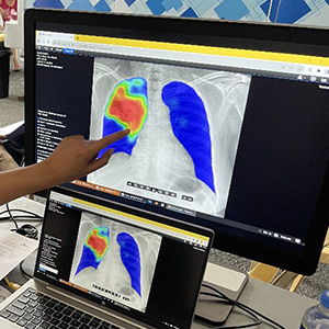 CADによって異常部位が色付けされた画像　© MSF