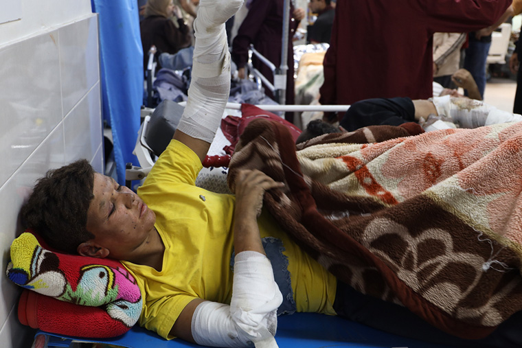 アル・シファ病院で横たわる患者＝2023年10月19日　Ⓒ Mohammad Masri