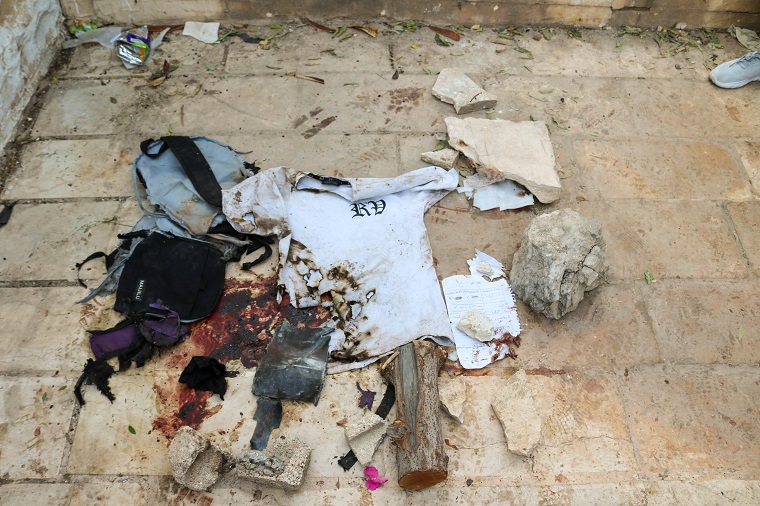 爆撃で子どもも犠牲になった　© MSF/Faris Al-Jawad