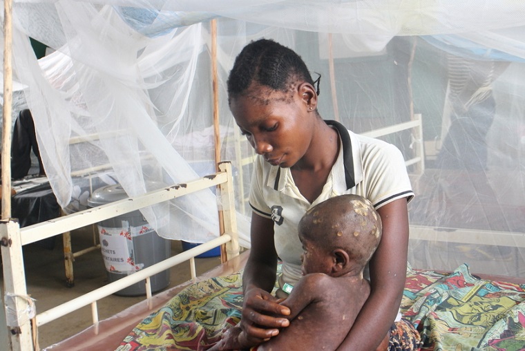 MSFが支援する現地の病院に入院する子とその母親　© Alain Duhamel Ntungane/MSF 