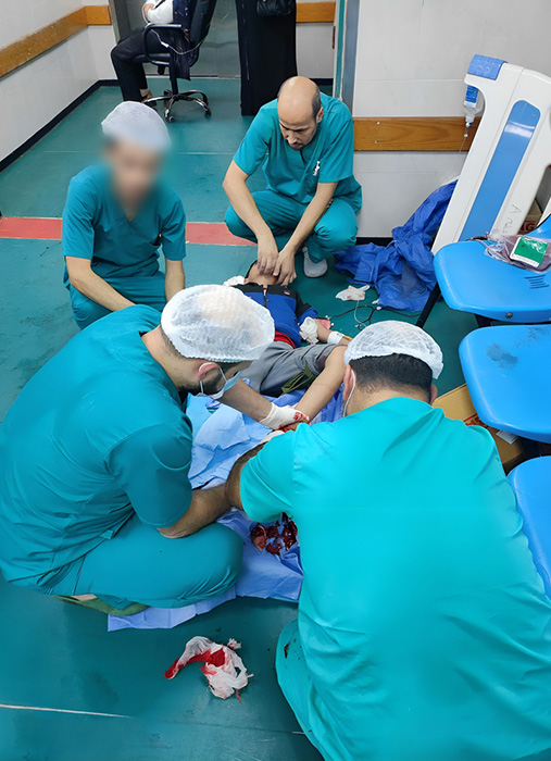 パレスチナ・ガザ地区：北部にあるシファ病院の床で、最低限の麻酔で少年の足を切断せざるを得ないMSFの医師たち。包囲された状況の中、医療施設や医療従事者も不足し始めていた＝2023年10月　Ⓒ MSF