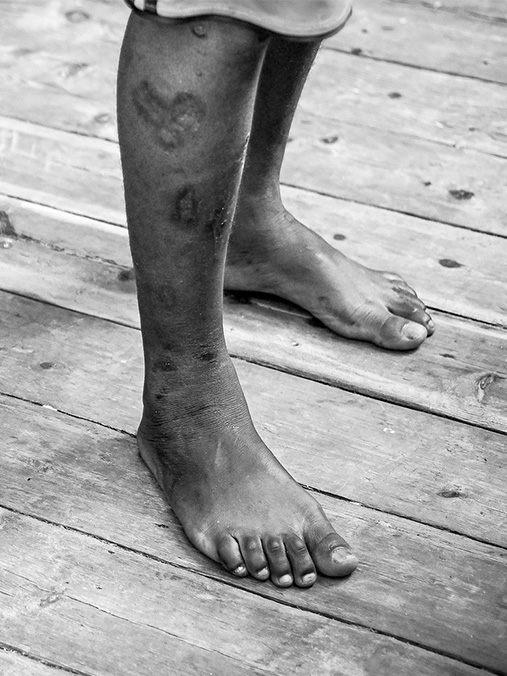 収容センター内にて受けた虐待を証言する男性 © MSF/Candida Lobes