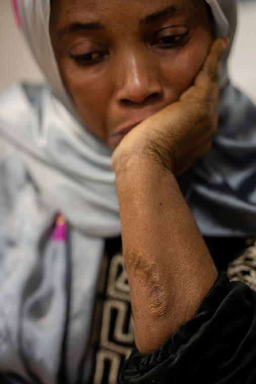 リビアの収容センターから逃走した際に有刺鉄線で負傷した女性　© Mahka Eslami 