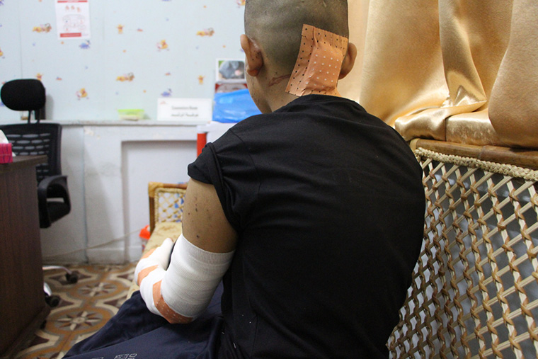 パレスチナ・ガザ地区に住む13歳のワエルさん。今年8月、複数のロケット弾がアパートを直撃し負傷した　Ⓒ MSF