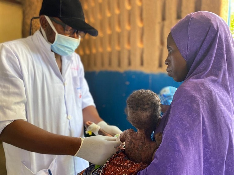 ナイジェリアとの国境近く、ニジェール南部ダン・イッサにある診療所で栄養失調の子どもを診察するMSFスタッフ＝2021年7月（※物語のモデルとなった親子ではありません） © MSF/Mariama Diallo