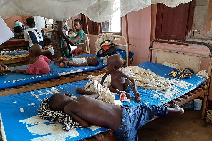 コンゴ、MSF支援先病院ではしかと栄養失調の治療を受ける子どもたち　© Assal Didier