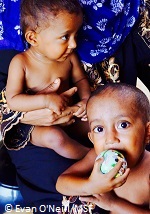重い下痢がロヒンギャの子どもを襲う
