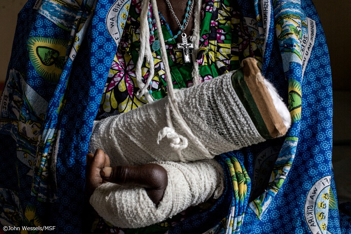 マシェット（大きな草刈り鎌）で腕と後頭部を切りつけられ、ブニアの病院で手当てを受ける50代の女性
