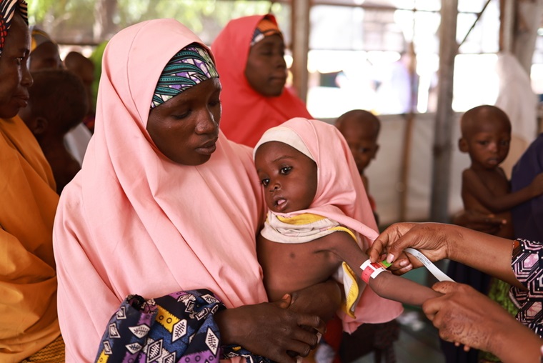栄養状態の測定を受ける子ども＝2024年10月29日　© Abba Adamu Musa/MSF