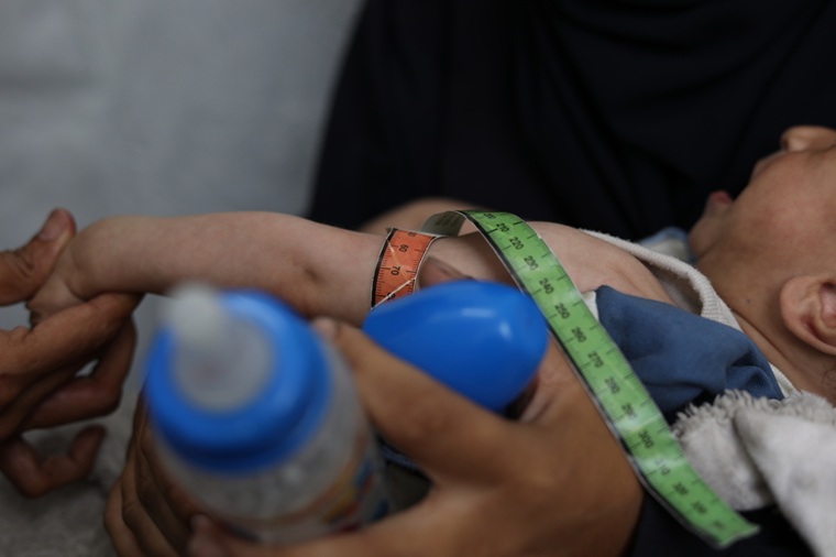ガザ北部の診療所で栄養失調の測定を受ける子ども=2025年6月4日 ⓒ Nour Alsaqqa/MSF
