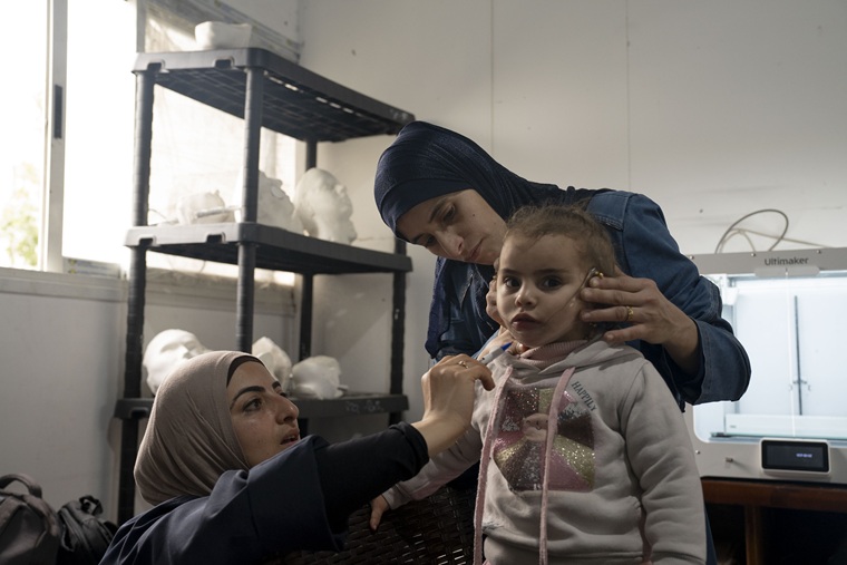 やけどを負った子どものケア（ガザ）　Ⓒ Nour Alsaqqa/MSF 