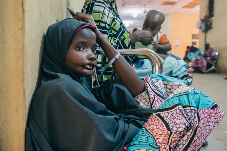 幼少期に水がんを発症し、手術のためにナイジェリアのソコト水がん病院を訪れる患者＝2017年10月18日　© Claire Jeantet - Fabrice Caterini/INEDIZ