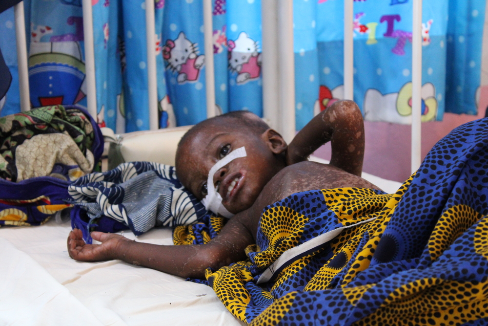 MSFの病院ではしかの治療を受けるハリマさんの子ども 🄫 MSF/Ghada Saafan