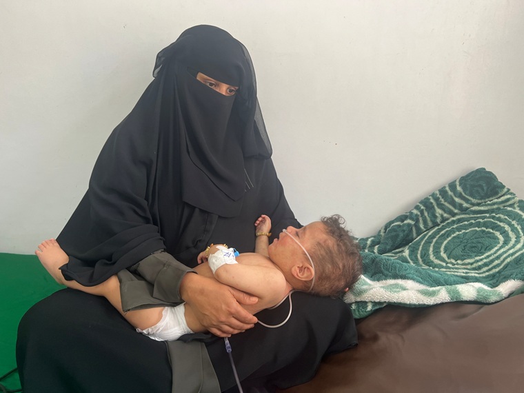 イエメン南西部ザマ—ルではしかにかかって入院した10カ月の息子を抱く母親 Ⓒ MSF
